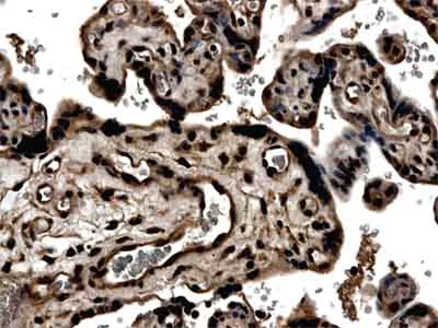 Immunohistochemistry (Formalin/PFA-fixed paraffin-embedded sections) - Anti-TIMP3 antibody [MM0036-7D3] (AB61316)