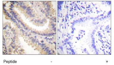 Immunohistochemistry (Formalin/PFA-fixed paraffin-embedded sections) - Anti-TIMP4 antibody (AB58425)