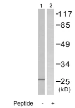 Western blot - Anti-TIMP4 antibody (AB58425)
