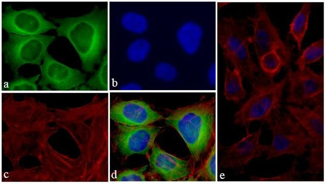 Immunocytochemistry/ Immunofluorescence - Anti-TIMP4 antibody [RP23040074] (AB313425), expandable thumbnail