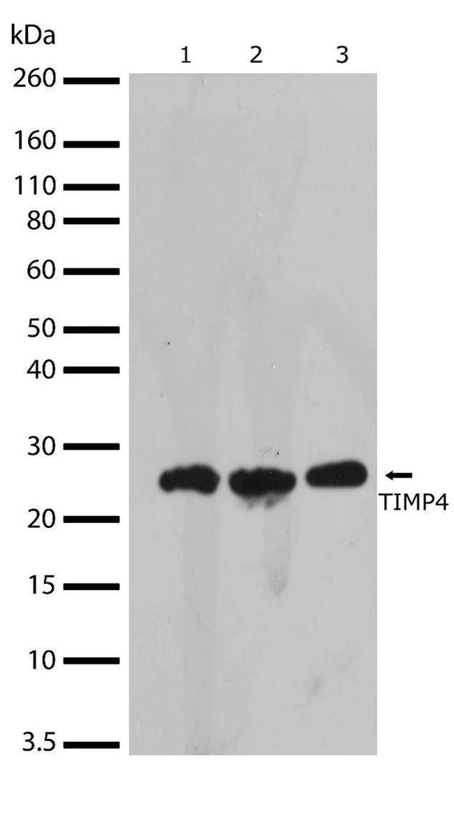 Western blot - Anti-TIMP4 antibody [RP23040074] (AB313425)