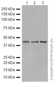 Western blot - Anti-Tin2 antibody [EPR15319] (AB197894)