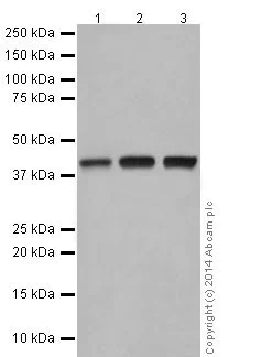 Western blot - Anti-Tin2 antibody [EPR15319] - BSA and Azide free (AB239012)