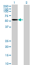Western blot - Anti-TINAGL1 antibody (AB69036)