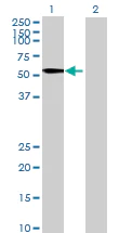 Western blot - Anti-TINAGL1 antibody (AB69036)