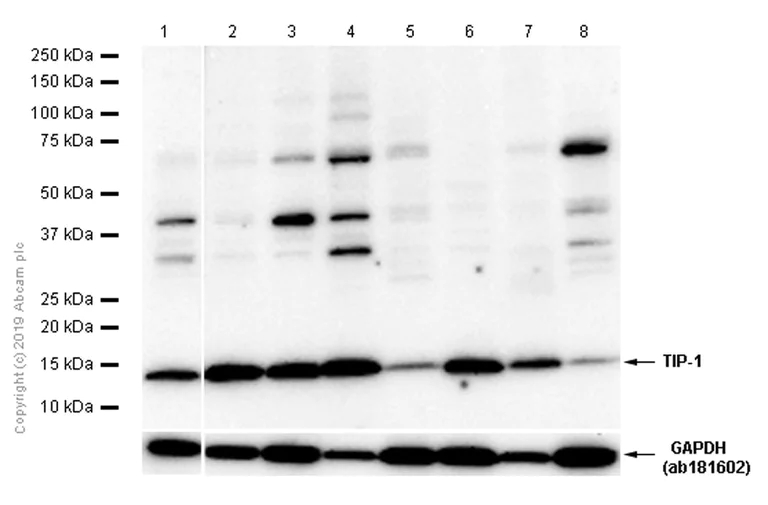 Western blot - Anti-TIP-1 antibody [EPR7900(2)] - BSA and Azide free (AB213403)