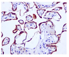 Immunohistochemistry (Formalin/PFA-fixed paraffin-embedded sections) - Anti-TIP30 antibody [EPR13179] (AB177961)