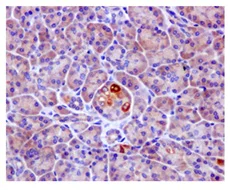 Immunohistochemistry (Formalin/PFA-fixed paraffin-embedded sections) - Anti-TIP30 antibody [EPR13179] - BSA and Azide free (AB250031)