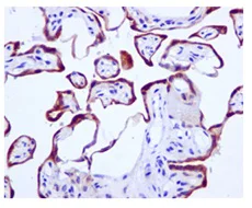 Immunohistochemistry (Formalin/PFA-fixed paraffin-embedded sections) - Anti-TIP30 antibody [EPR13179] - BSA and Azide free (AB250031)