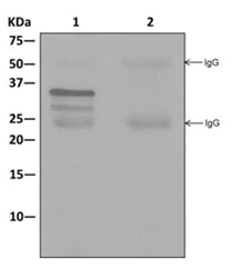 Immunoprecipitation - Anti-TIP30 antibody [EPR13179] - BSA and Azide free (AB250031)