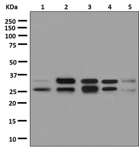 Western blot - Anti-TIP30 antibody [EPR13185] (AB181378)