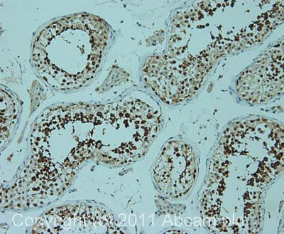 Immunohistochemistry (Formalin/PFA-fixed paraffin-embedded sections) - Anti-TIP49A antibody [2943C1a] (AB51500)