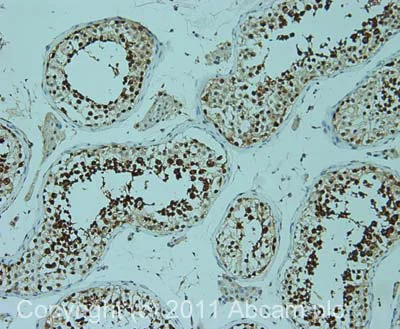 Immunohistochemistry (Formalin/PFA-fixed paraffin-embedded sections) - Anti-TIP49A antibody [2943C1a] (AB51500)