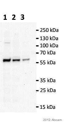 Western blot - Anti-TIP49A antibody [2943C1a] (AB51500)