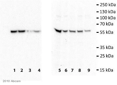 Western blot - Anti-TIP49A antibody [2943C1a] (AB51500)