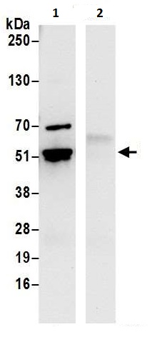 Immunoprecipitation - Anti-TIP49A antibody (AB226001)