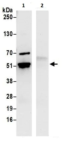 Immunoprecipitation - Anti-TIP49A antibody (AB226001)
