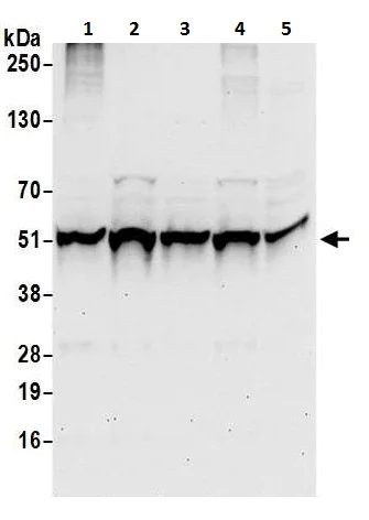 Western blot - Anti-TIP49A antibody (AB226001)