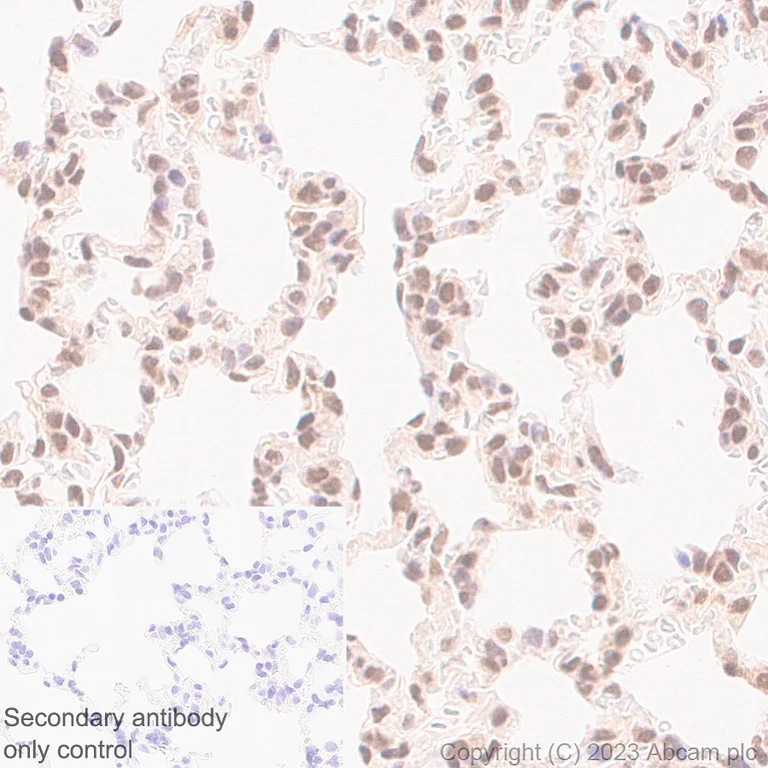 Immunohistochemistry (Formalin/PFA-fixed paraffin-embedded sections) - Anti-TIP49A antibody [EPR28169-31] (AB316004)