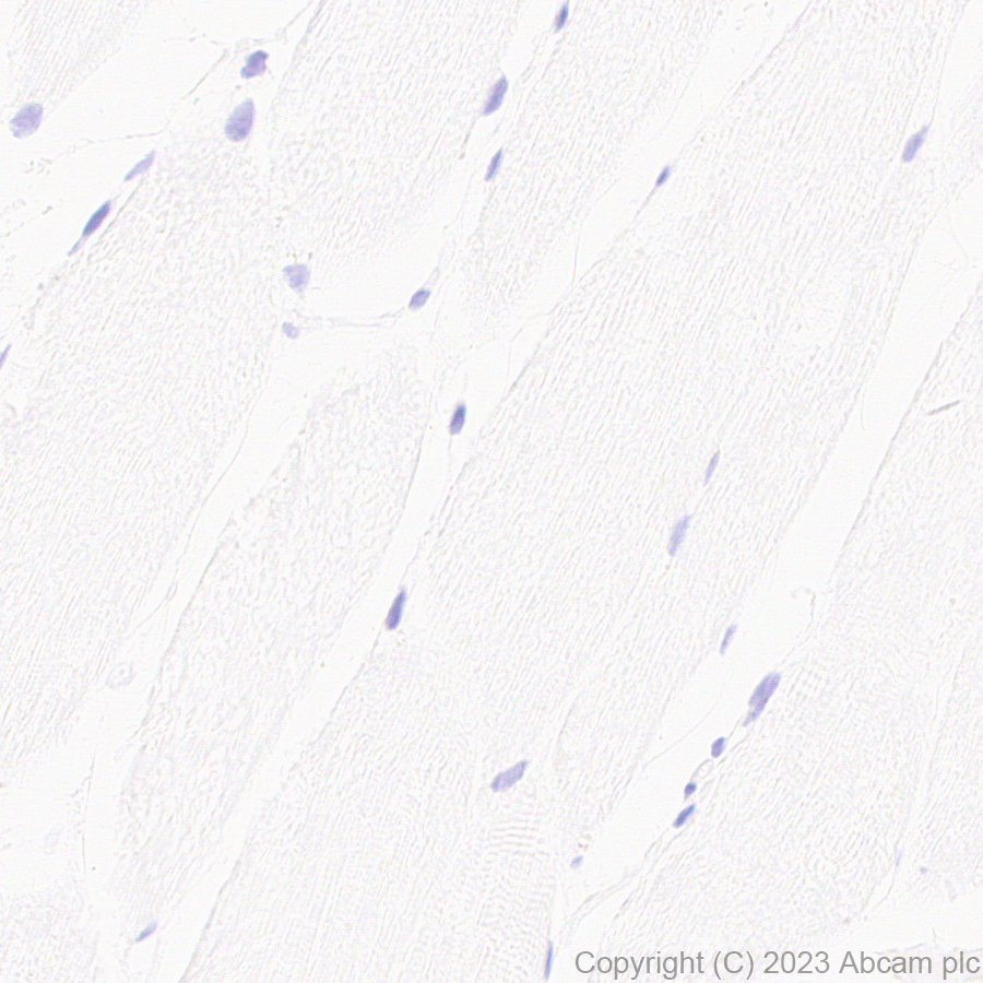 Immunohistochemistry (Formalin/PFA-fixed paraffin-embedded sections) - Anti-TIP49A antibody [EPR28169-31] (AB316004)