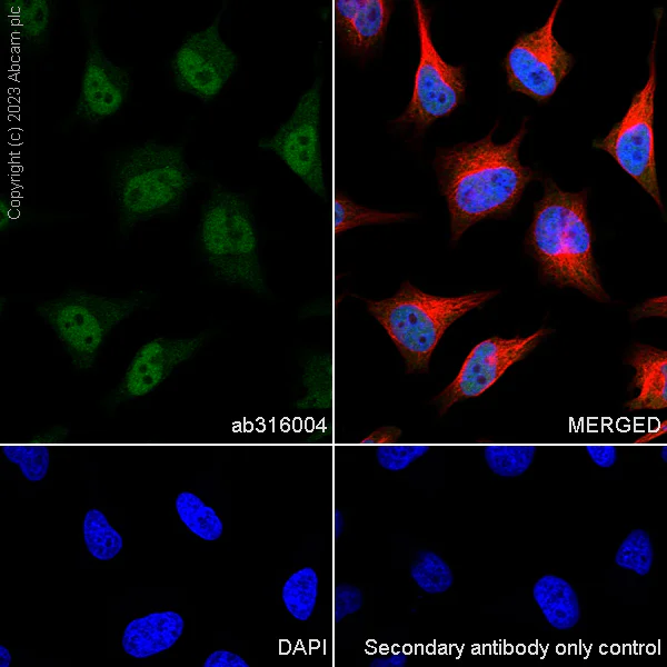Immunocytochemistry/ Immunofluorescence - Anti-TIP49A antibody [EPR28169-31] - BSA and Azide free (AB316005)
