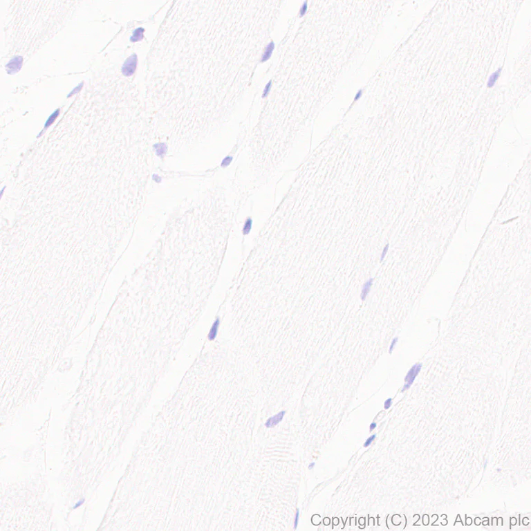 Immunohistochemistry (Formalin/PFA-fixed paraffin-embedded sections) - Anti-TIP49A antibody [EPR28169-31] - BSA and Azide free (AB316005)