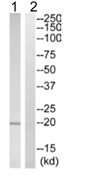 Western blot - Anti-TIPE2 antibody (AB110389), expandable thumbnail