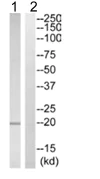 Western blot - Anti-TIPE2 antibody (AB110389)