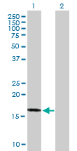 Western blot - Anti-TIPE2 antibody (AB169616)
