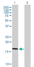 Western blot - Anti-TIPE2 antibody (AB169616)