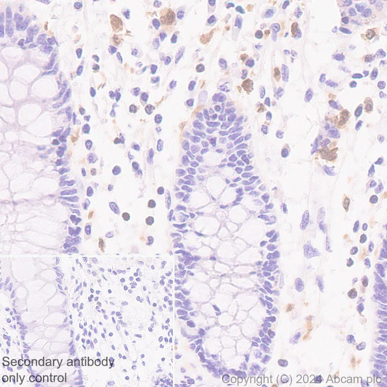 Immunohistochemistry (Formalin/PFA-fixed paraffin-embedded sections) - Anti-TIPE2 antibody [EPR27964-2] (AB316848)