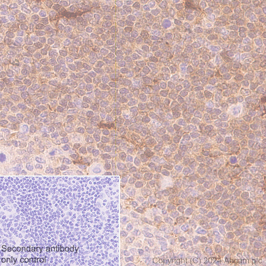Immunohistochemistry (Formalin/PFA-fixed paraffin-embedded sections) - Anti-TIPE2 antibody [EPR27964-2] - BSA and Azide free (ab316849), expandable thumbnail