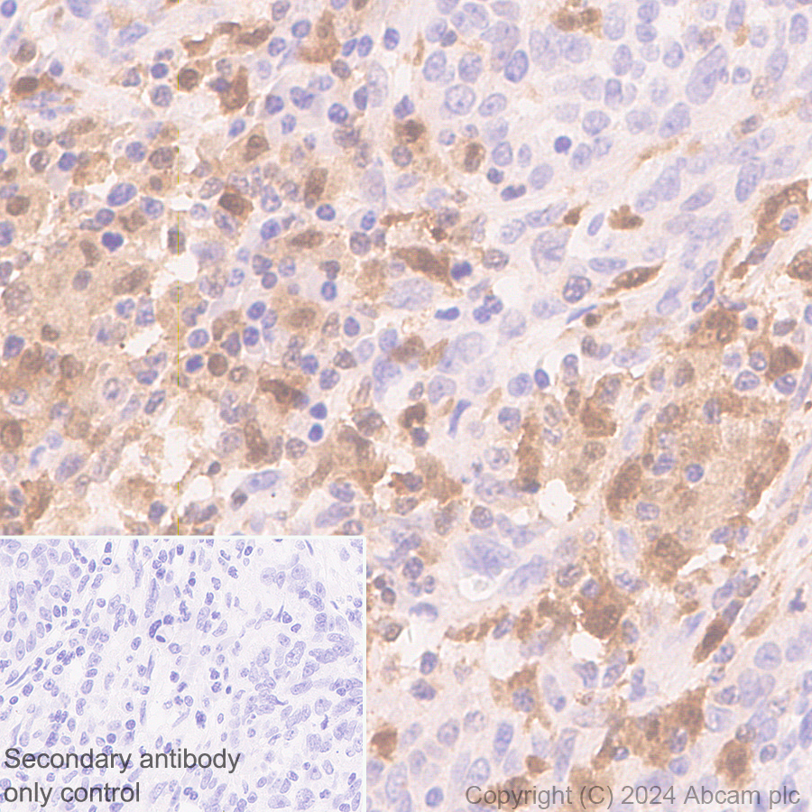 Immunohistochemistry (Formalin/PFA-fixed paraffin-embedded sections) - Anti-TIPE2 antibody [EPR27964-2] - BSA and Azide free (ab316849), expandable thumbnail