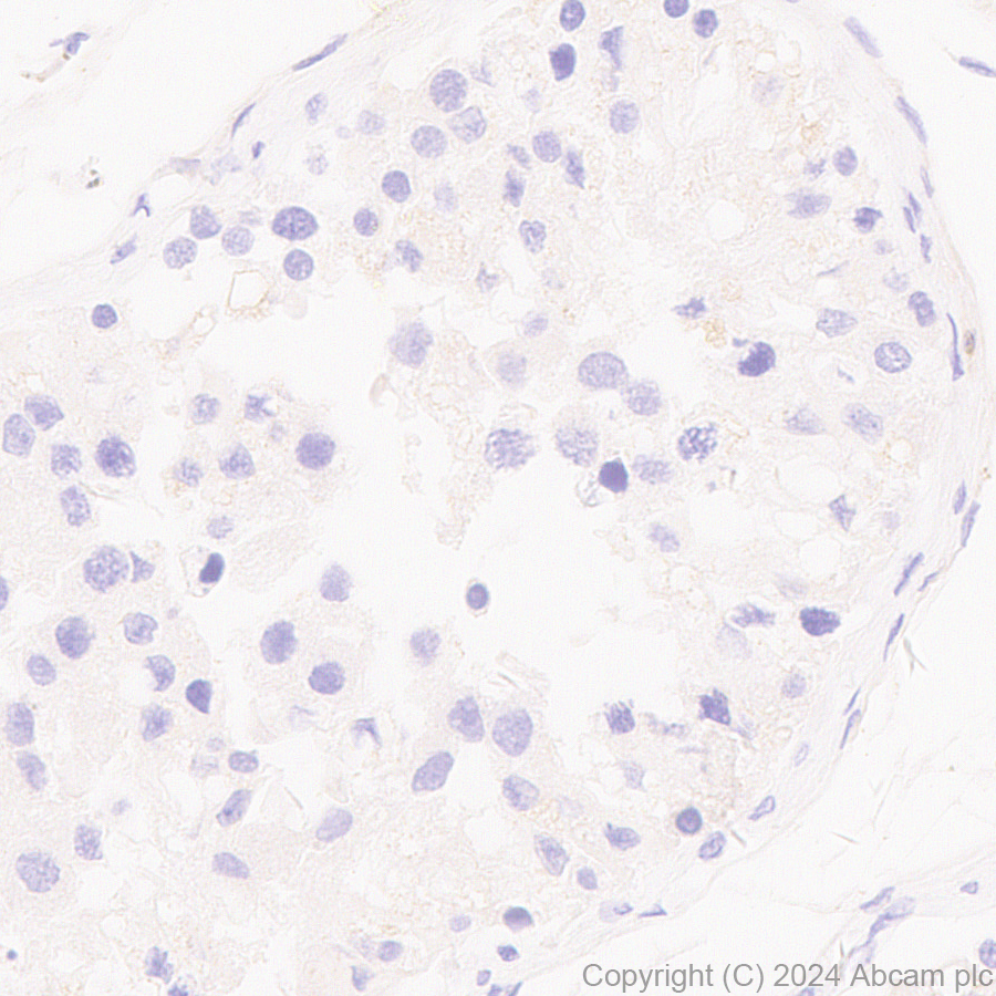 Immunohistochemistry (Formalin/PFA-fixed paraffin-embedded sections) - Anti-TIPE2 antibody [EPR27964-2] - BSA and Azide free (AB316849), expandable thumbnail