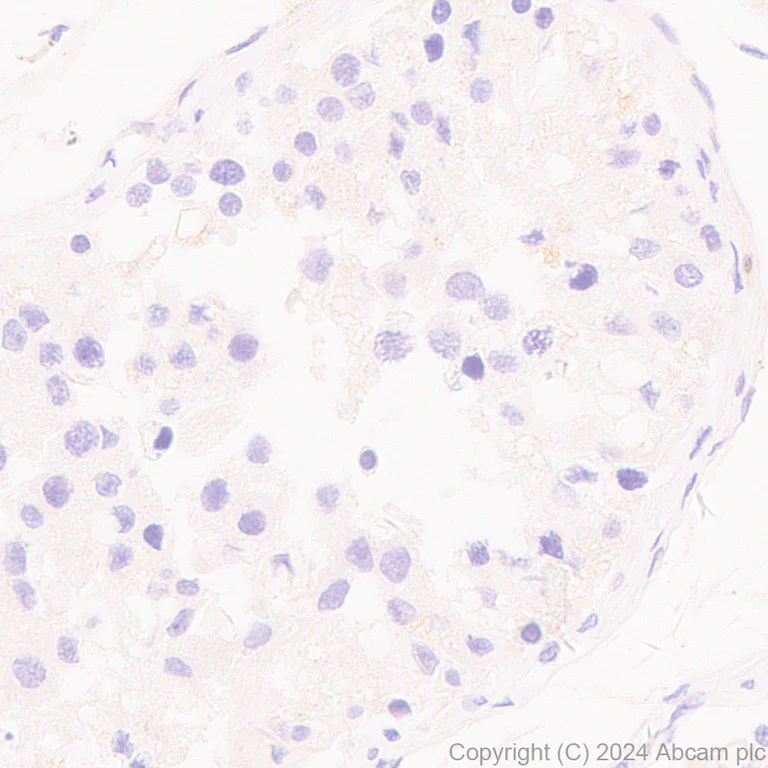 Immunohistochemistry (Formalin/PFA-fixed paraffin-embedded sections) - Anti-TIPE2 antibody [EPR27964-2] - BSA and Azide free (AB316849)