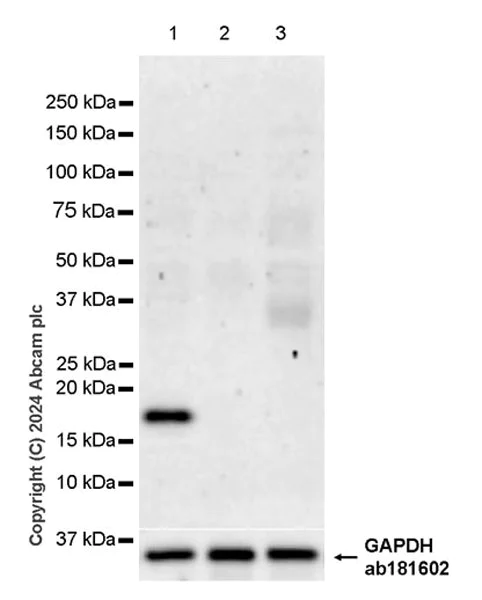 Western blot - Anti-TIPE2 antibody [EPR27964-2] - BSA and Azide free (AB316849)