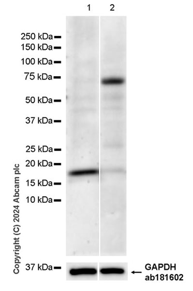 Western blot - Anti-TIPE2 antibody [EPR27964-2] - BSA and Azide free (AB316849), expandable thumbnail
