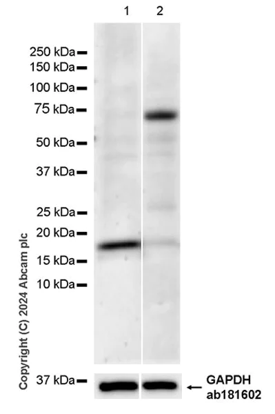 Western blot - Anti-TIPE2 antibody [EPR27964-2] - BSA and Azide free (AB316849)