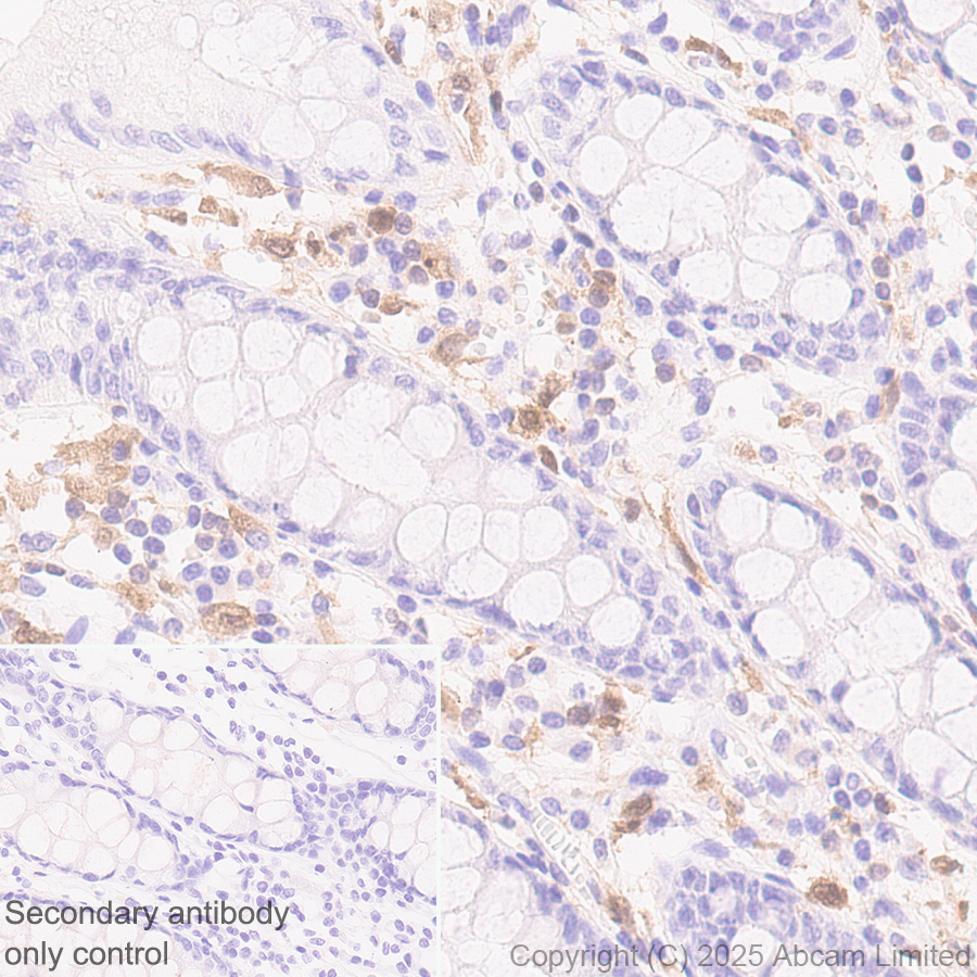 Immunohistochemistry (Formalin/PFA-fixed paraffin-embedded sections) - Anti-TIPE2 antibody [EPR27964-44] (ab324268), expandable thumbnail