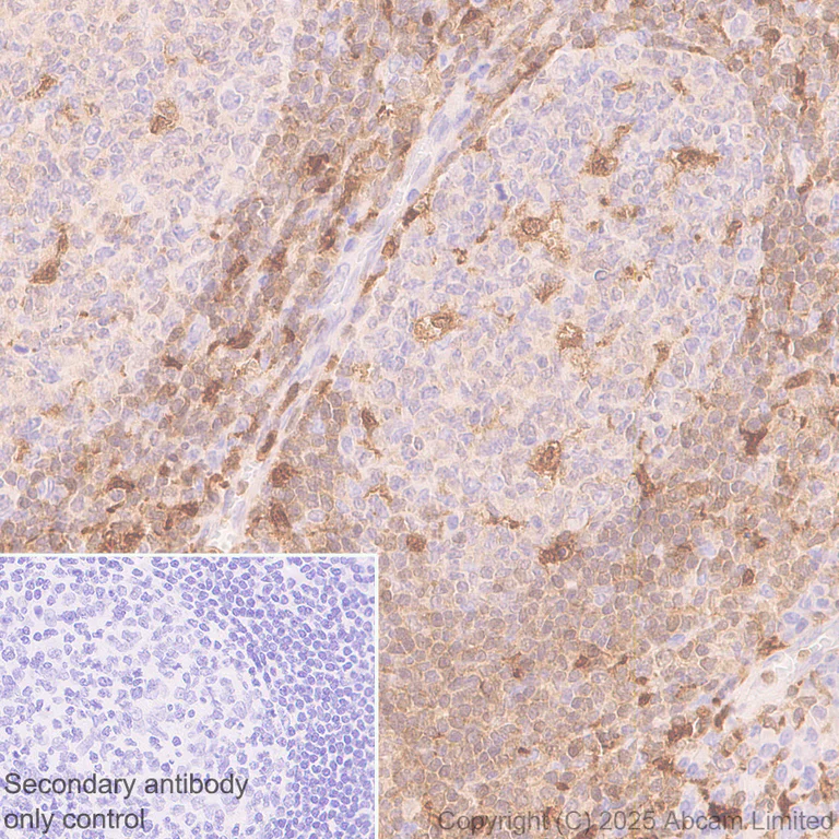 Immunohistochemistry (Formalin/PFA-fixed paraffin-embedded sections) - Anti-TIPE2 antibody [EPR27964-44] (AB324268)