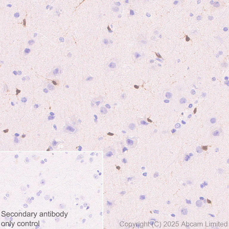 Immunohistochemistry (Formalin/PFA-fixed paraffin-embedded sections) - Anti-TIPE2 antibody [EPR27964-44] (AB324268)