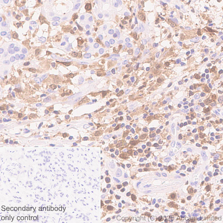 Immunohistochemistry (Formalin/PFA-fixed paraffin-embedded sections) - Anti-TIPE2 antibody [EPR27964-44] (AB324268)