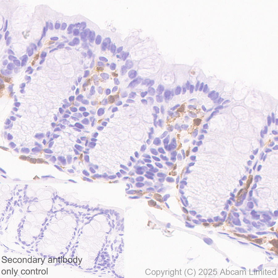 Immunohistochemistry (Formalin/PFA-fixed paraffin-embedded sections) - Anti-TIPE2 antibody [EPR27964-44] (AB324268), expandable thumbnail