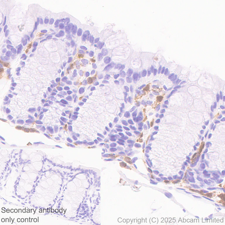 Immunohistochemistry (Formalin/PFA-fixed paraffin-embedded sections) - Anti-TIPE2 antibody [EPR27964-44] (AB324268)