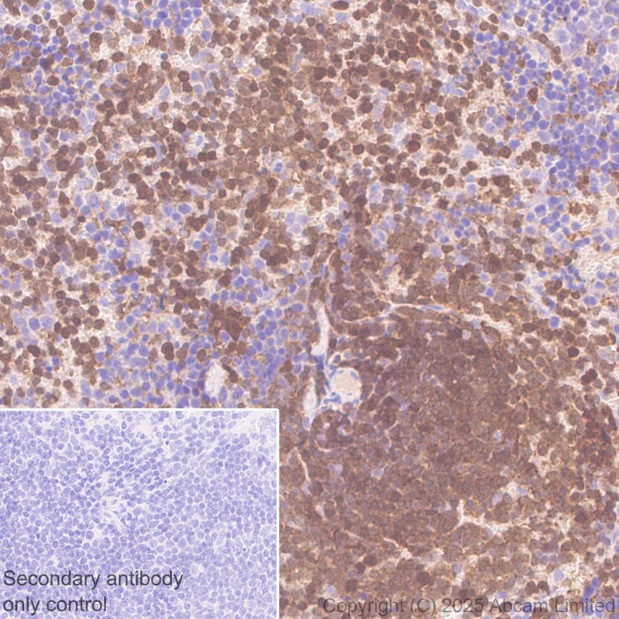 Immunohistochemistry (Formalin/PFA-fixed paraffin-embedded sections) - Anti-TIPE2 antibody [EPR27964-44] (AB324268), expandable thumbnail
