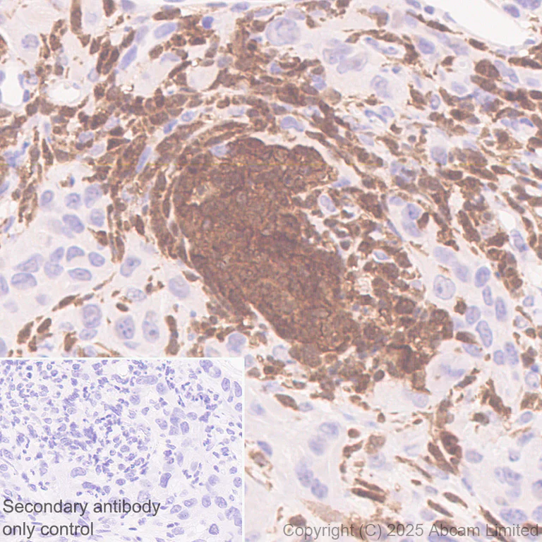 Immunohistochemistry (Formalin/PFA-fixed paraffin-embedded sections) - Anti-TIPE2 antibody [EPR27964-44] (AB324268)