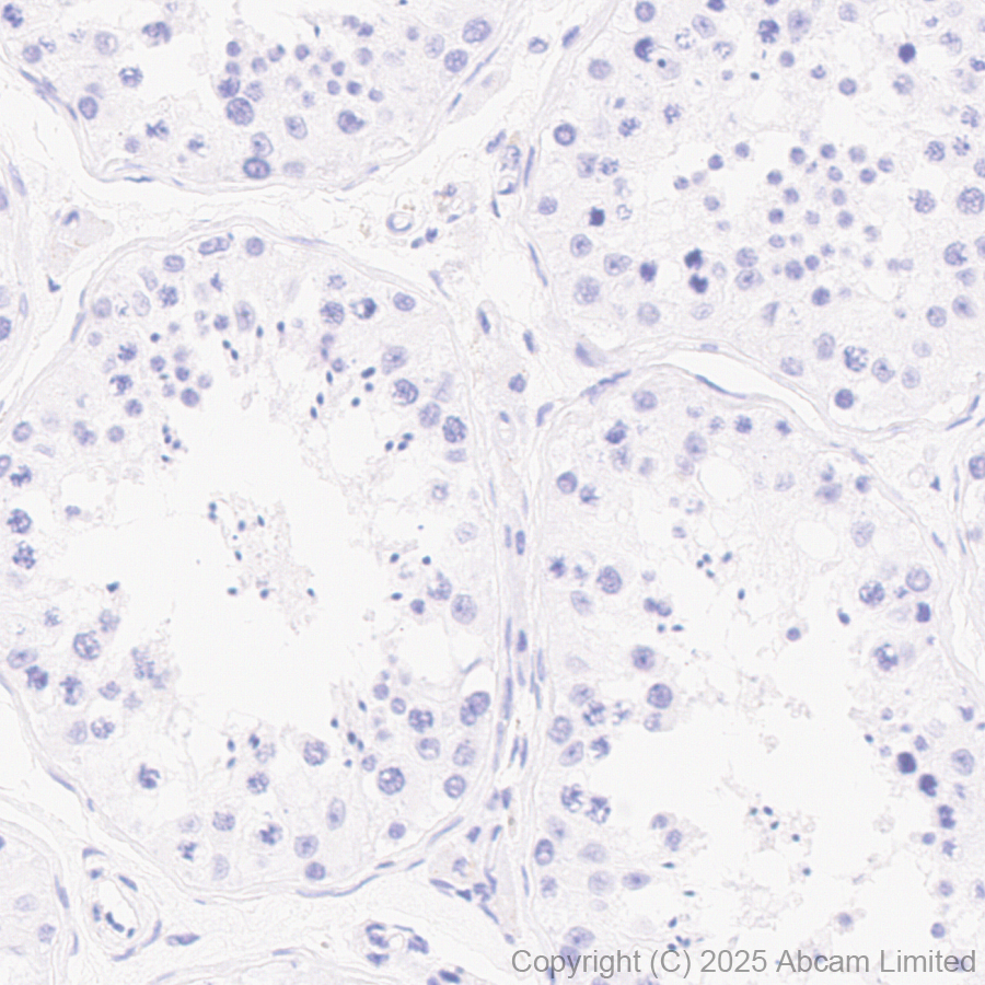 Immunohistochemistry (Formalin/PFA-fixed paraffin-embedded sections) - Anti-TIPE2 antibody [EPR27964-44] (ab324268), expandable thumbnail