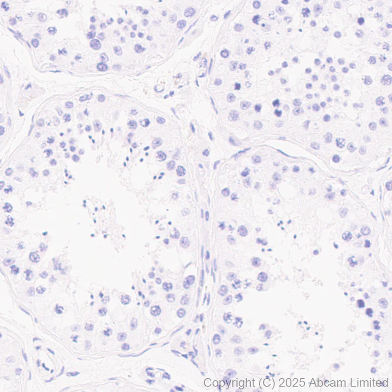 Immunohistochemistry (Formalin/PFA-fixed paraffin-embedded sections) - Anti-TIPE2 antibody [EPR27964-44] (AB324268)