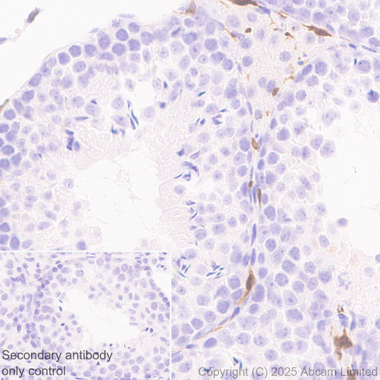 Immunohistochemistry (Formalin/PFA-fixed paraffin-embedded sections) - Anti-TIPE2 antibody [EPR27964-44] (AB324268)