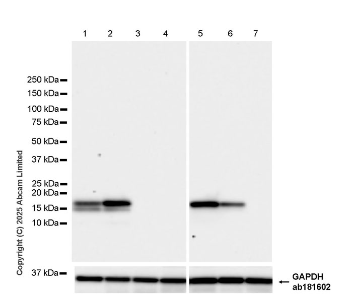 Western blot - Anti-TIPE2 antibody [EPR27964-44] (ab324268), expandable thumbnail